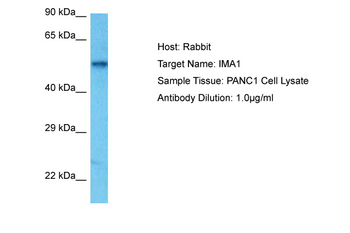 KPNA2 Rabbit Polyclonal Antibody