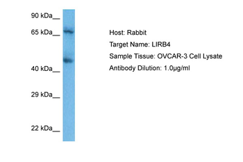 LILRB4 Rabbit Polyclonal Antibody
