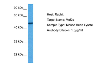 MEF2C Rabbit Polyclonal Antibody