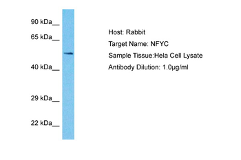NFYC Rabbit Polyclonal Antibody