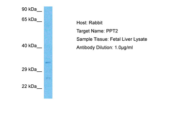 PPT2 Rabbit Polyclonal Antibody