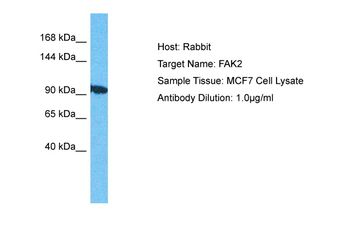 PTK2B Rabbit Polyclonal Antibody