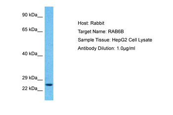RAB6B Rabbit Polyclonal Antibody