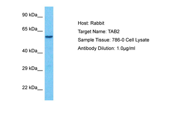 TAB2 Rabbit Polyclonal Antibody