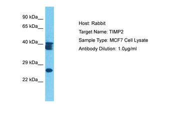 TIMP2 Rabbit Polyclonal Antibody