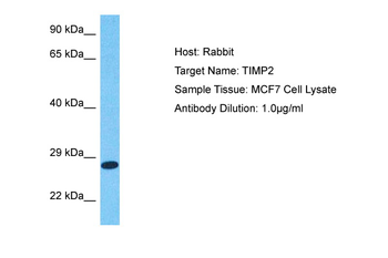 TIMP2 Rabbit Polyclonal Antibody