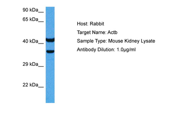 ACTB Rabbit Polyclonal Antibody