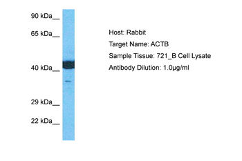 ACTB Rabbit Polyclonal Antibody