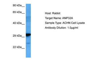 ANP32A Rabbit Polyclonal Antibody