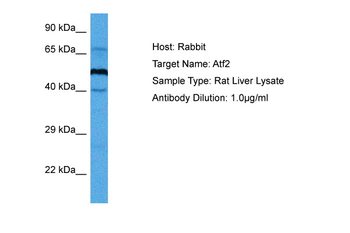 ATF2 Rabbit Polyclonal Antibody