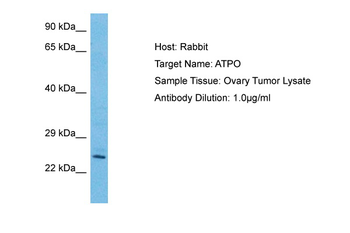 ATP5PO Rabbit Polyclonal Antibody