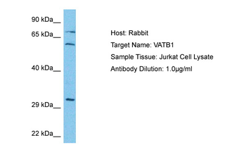 ATP6V1B1 Rabbit Polyclonal Antibody