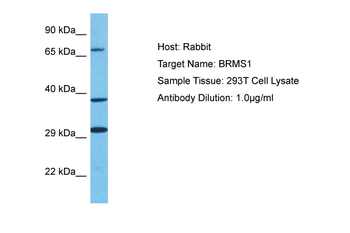 BRMS1 Rabbit Polyclonal Antibody