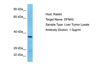 GSDME Rabbit Polyclonal Antibody