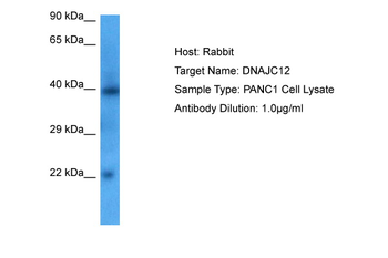 DNAJC12 Rabbit Polyclonal Antibody