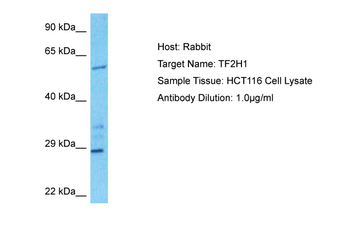 GTF2H1 Rabbit Polyclonal Antibody