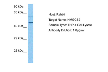 HMGCS2 Rabbit Polyclonal Antibody