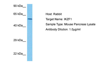 IKZF1 Rabbit Polyclonal Antibody