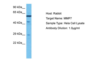MMP7 Rabbit Polyclonal Antibody