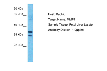 MMP7 Rabbit Polyclonal Antibody