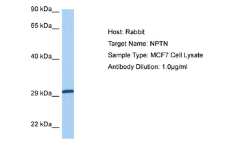 NPTN Rabbit Polyclonal Antibody