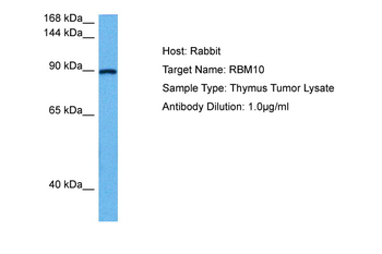 RBM10 Rabbit Polyclonal Antibody