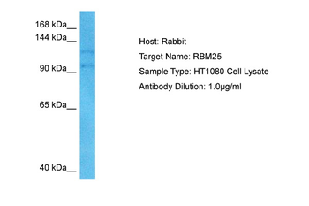 RBM25 Rabbit Polyclonal Antibody