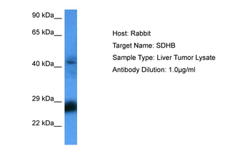 SDHB Rabbit Polyclonal Antibody