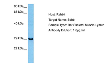 SDHB Rabbit Polyclonal Antibody