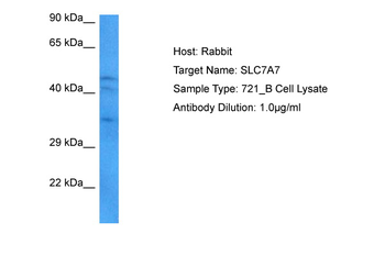 SLC7A7 Rabbit Polyclonal Antibody