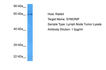 SYNCRIP Rabbit Polyclonal Antibody