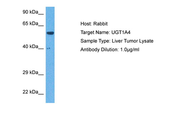 UGT1A4 Rabbit Polyclonal Antibody