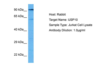 USP10 Rabbit Polyclonal Antibody