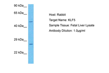 KLF5 Rabbit Polyclonal Antibody