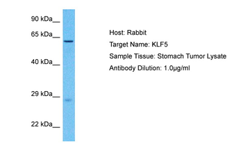 KLF5 Rabbit Polyclonal Antibody
