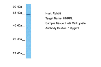 HNRNPL Rabbit Polyclonal Antibody