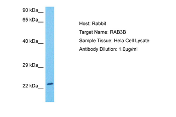 RAB3B Rabbit Polyclonal Antibody