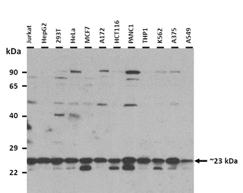 RAB7A Rabbit Polyclonal Antibody