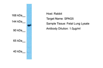 SPAG5 Rabbit Polyclonal Antibody