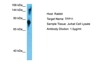 TFIP11 Rabbit Polyclonal Antibody