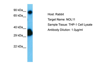 NOL11 Rabbit Polyclonal Antibody