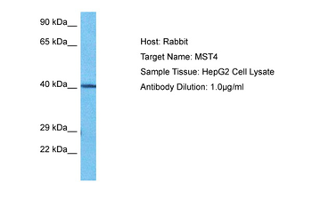 STK26 Rabbit Polyclonal Antibody