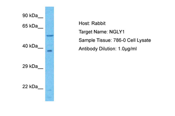 NGLY1 Rabbit Polyclonal Antibody