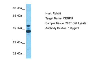 CENPU Rabbit Polyclonal Antibody
