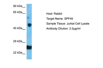 RBM17 Rabbit Polyclonal Antibody