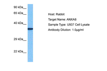 ANXA8L2 Rabbit Polyclonal Antibody