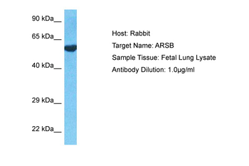 ARSB Rabbit Polyclonal Antibody