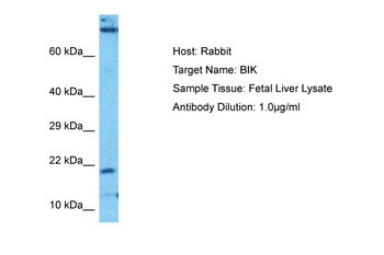 BIK Rabbit Polyclonal Antibody