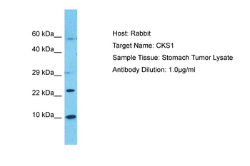 CKS1B Rabbit Polyclonal Antibody
