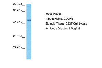 CLCN5 Rabbit Polyclonal Antibody